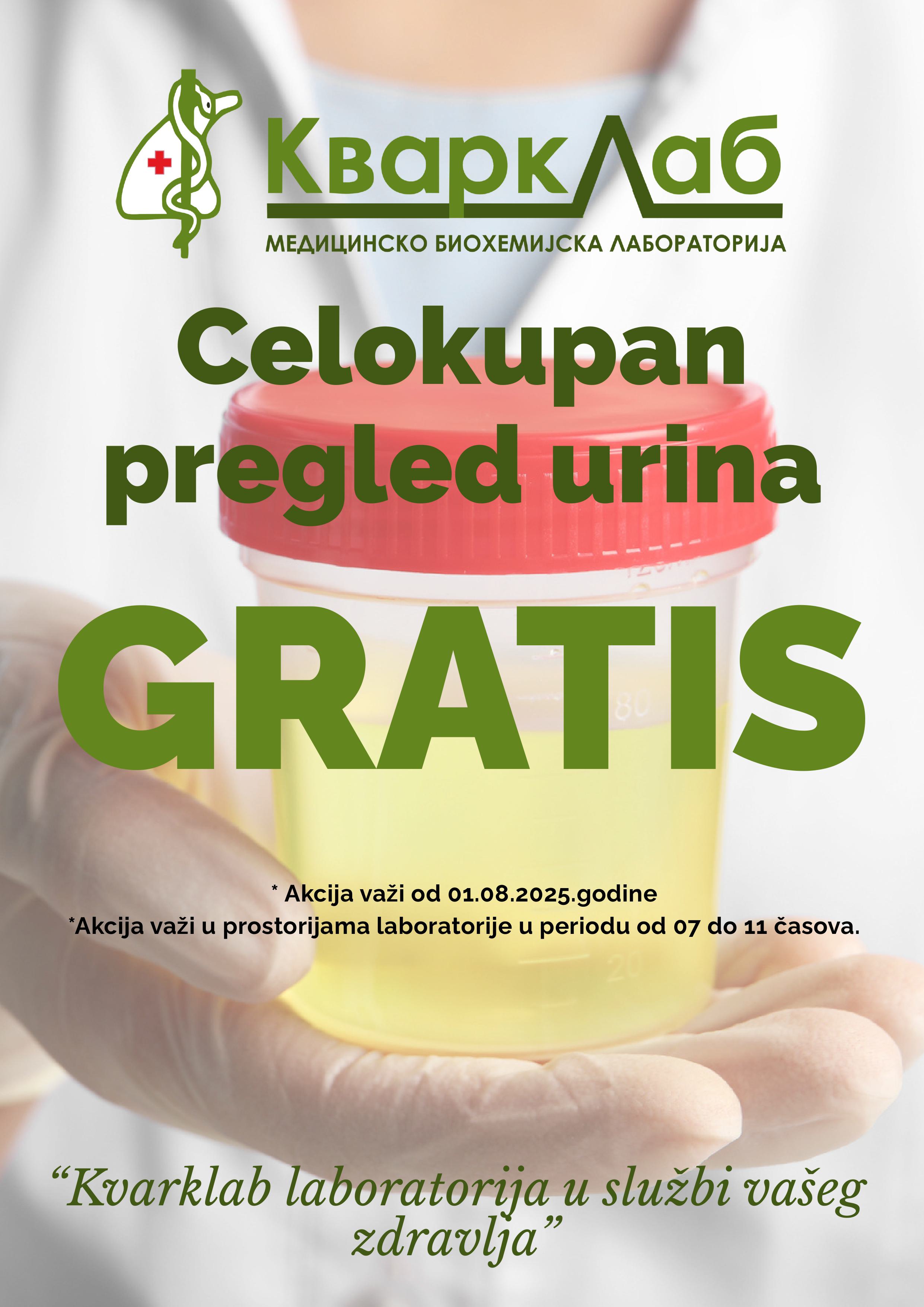 GRATIS OPŠTI PREGLED URINA